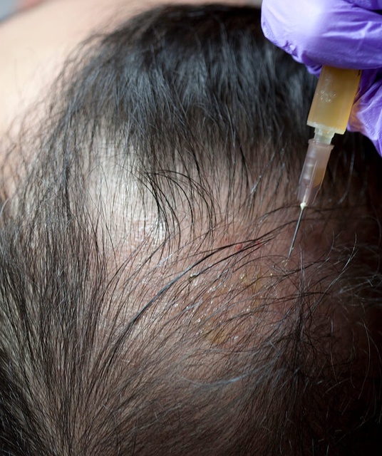 avatar treatwellcouk